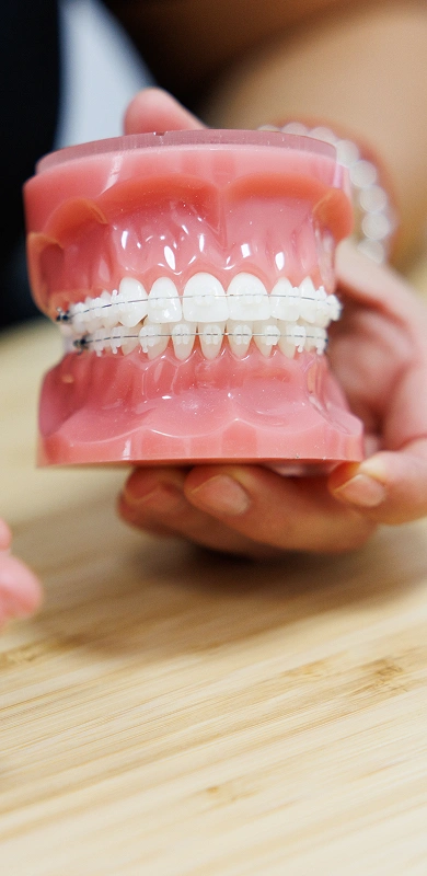 img-etnaverdu-brackets-01-390x800-0