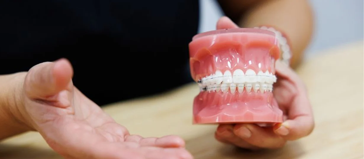 Cómo aliviar dolor con brackets los primeros días con cera, frío local y alimentos blandos